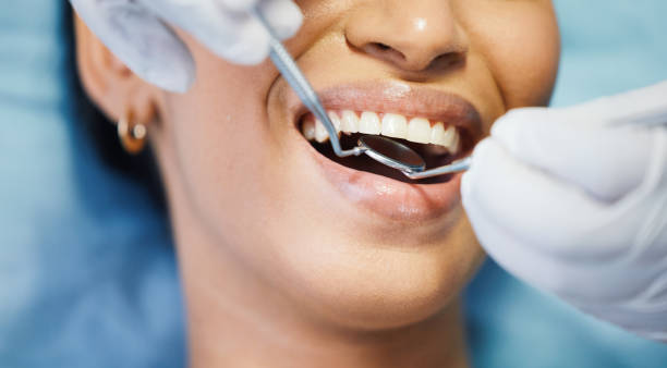 Best Emergency Dental Care for Sports Injuries in Forks, WA